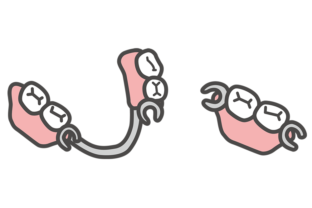 入れ歯治療の特徴